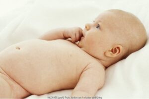 Mengatasi Penyakit Kuning pada Bayi