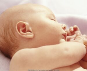 Mengobati Jerawat Pada Bayi