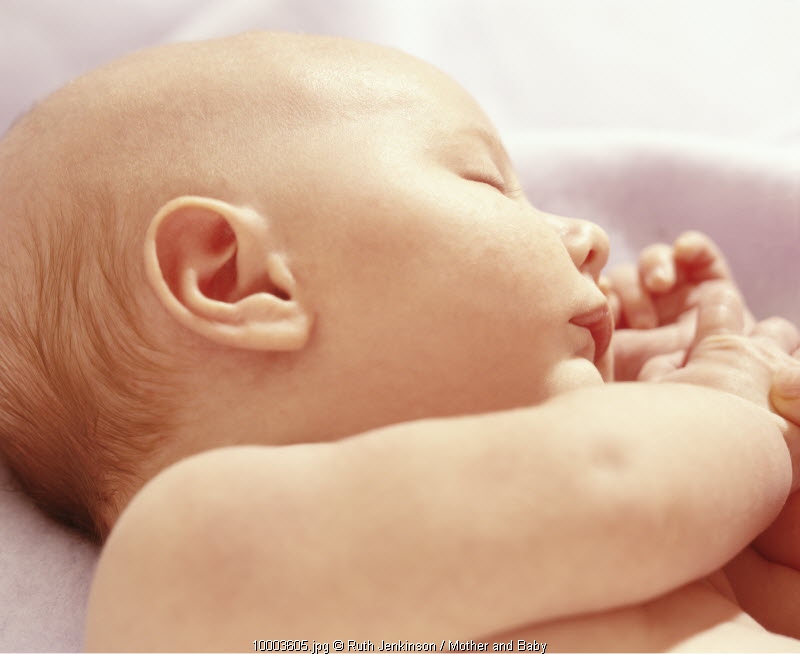 Mengobati Jerawat Pada Bayi