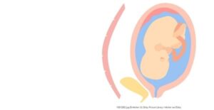 Jika Janin Gagal Tumbuh