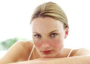 Lupus, Si Seribu Wajah