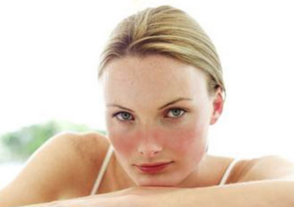 Lupus, Si Seribu Wajah