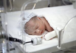 Cacat Bawaan pada Bayi