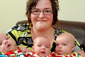 Hamil Berkat Operasi Lambung