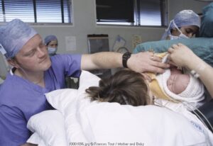 Waspadai Infeksi Pasca-Caesar