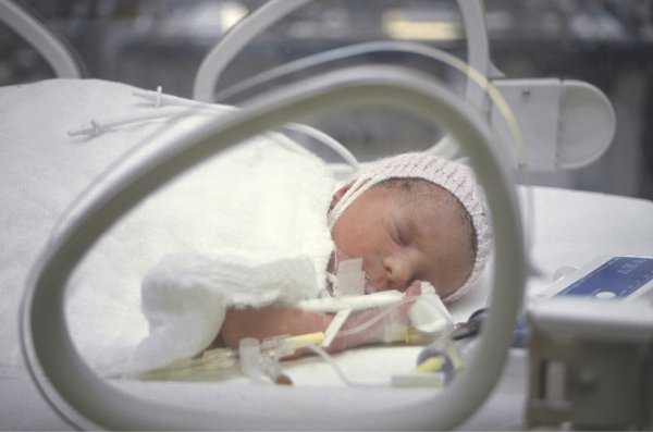 Mengenal Neonatal Sepsis