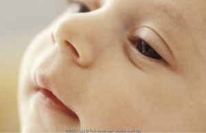 Atasi Mata Lengket pada Bayi