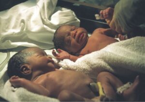 Satu dari Lima Bayi Kembar Meninggal Akibat Gagal Napas