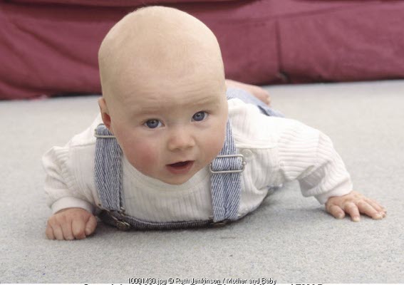 Mengenal Cerebral Palsy pada Bayi