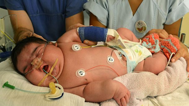 Langka, Bayi Berbobot 6 Kg Dilahirkan Normal