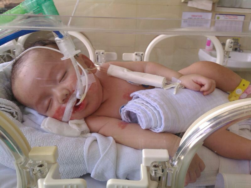 Janisha Floreine dan Maple Syrup Urine Disease (MSUD)