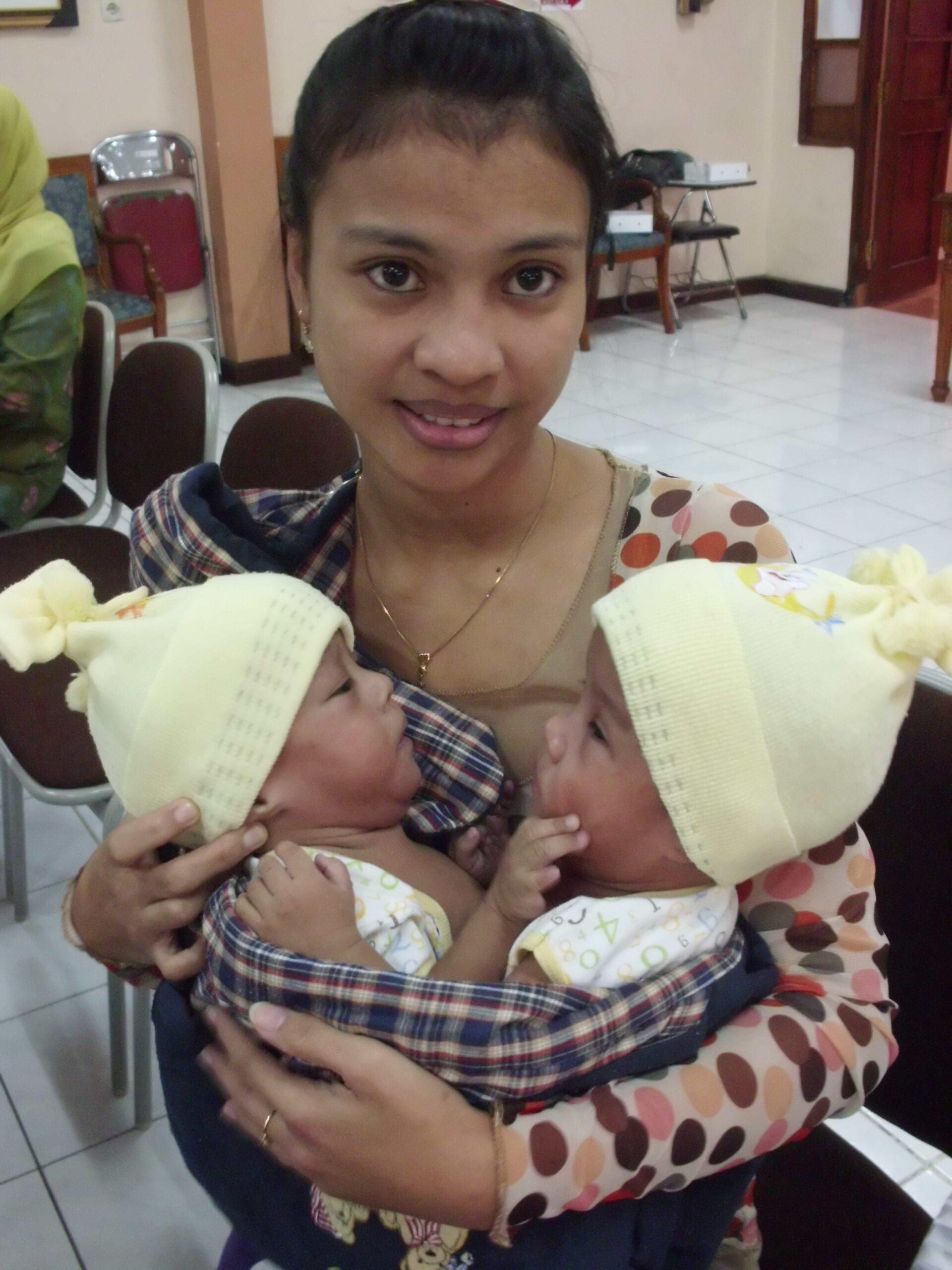 Fenomena Kembar Siam (1): Ini Siklus 5 Tahunan