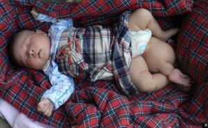 Bayi Lahir dengan Tiga Kaki