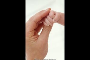 Kenali Celebral Palsy Sejak Dini