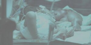 Kembar Parasit (1): Ginan dan Kembaran Dalam Mulut