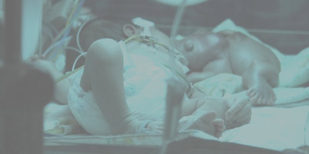 Kembar Parasit (1): Ginan dan Kembaran Dalam Mulut