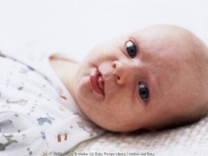 Jika Kulit Si Kecil Kering