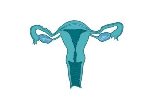 Ragam Bentuk dan Masalah Rahim (2)