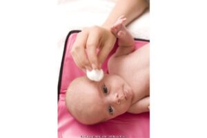 Kenali Penyebab Mata Merah Si Kecil (1)