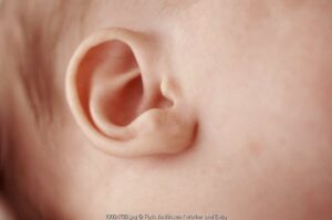 Suara Bising Bisa Merusak Otak Bayi