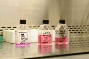 5 Alasan Terpenting Menyimpan Darah Tali Pusat