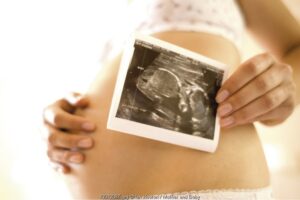 Kegemukan saat Hamil Pengaruhi IQ Anak?