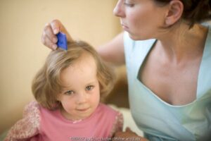 Kerontokan Rambut pada Anak Pengidap Kanker