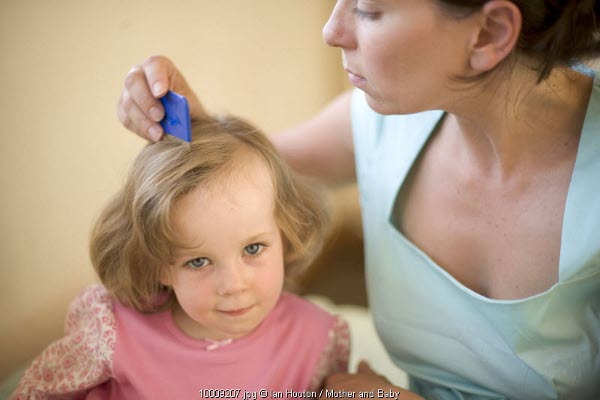Kerontokan Rambut pada Anak Pengidap Kanker