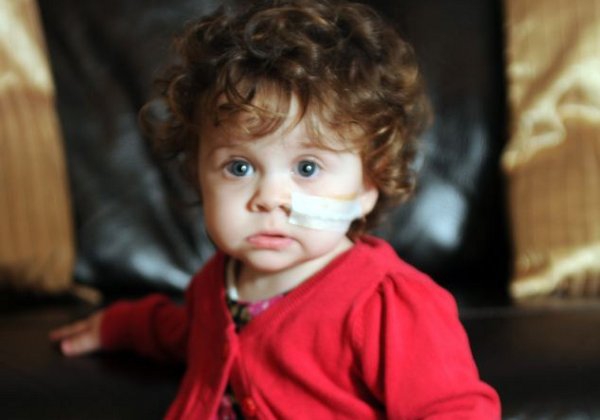 Balita dengan Kelainan Gastroschisis