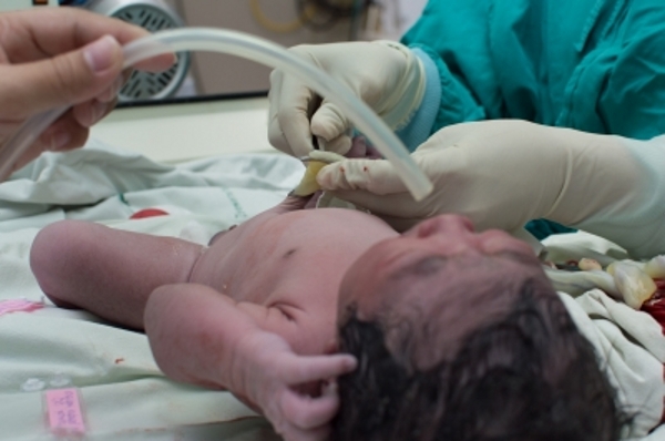 Risiko Paru-paru Kronis Bayi Prematur