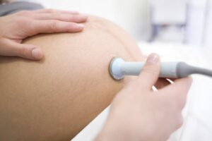 Mencegah Risiko Keguguran