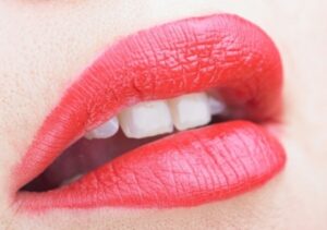 Sariawan Bersifat Genetik