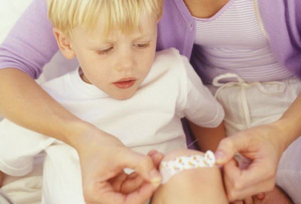 Menyamarkan Bekas Luka