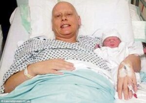 Mastektomi setelah Persalinan