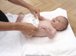 Cegah Ruam Popok Pada Bayi