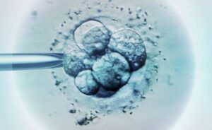 Tes DNA Tingkatkan Keberhasilan IVF