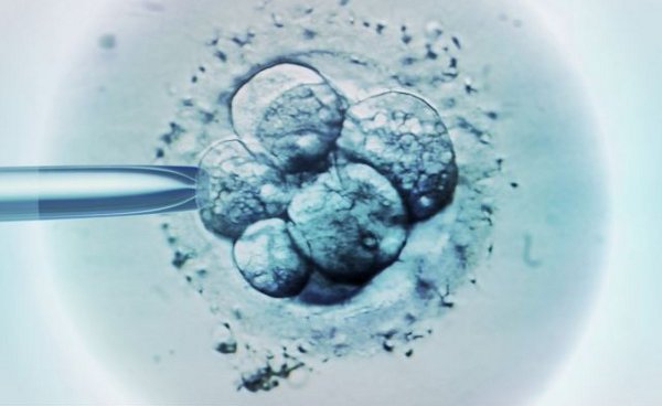 Tes DNA Tingkatkan Keberhasilan IVF