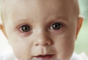 Gadget Sebabkan Gangguan Mata Balita