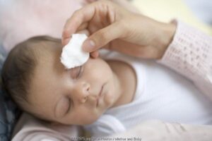 Waspada Belekan Pada Bayi