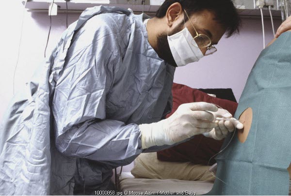 Melahirkan Tanpa Sakit