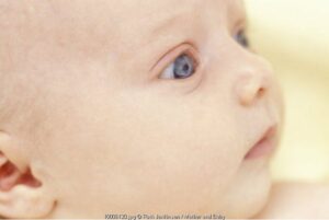 Timbul Katarak Setelah Lahir