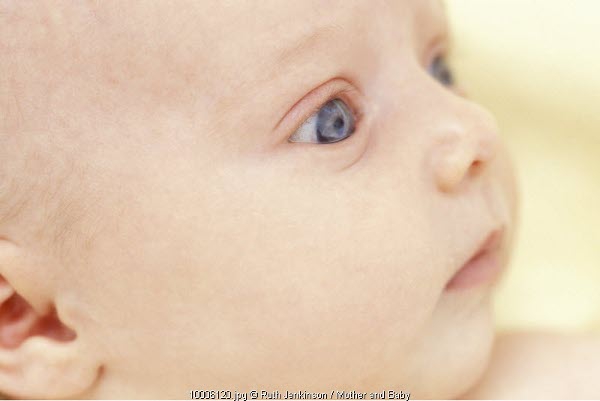 Timbul Katarak Setelah Lahir