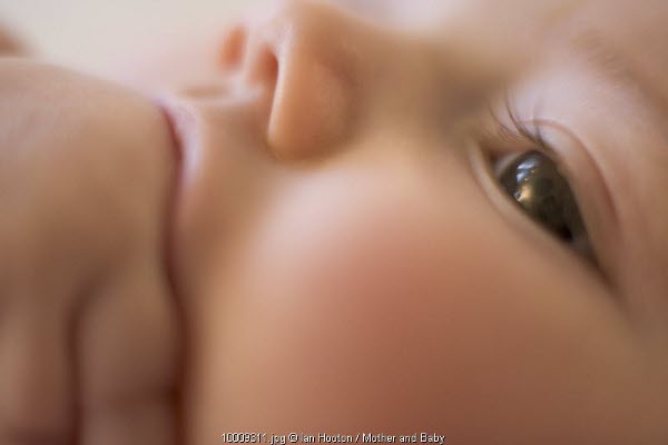 Infeksi Impetigo di Kulit Si Kecil