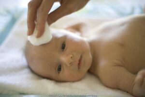 Jika Kulit Wajah Bayi Kasar