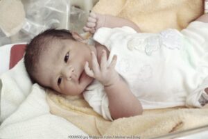 Bayi Terlambat Lahir, Perlu Diinduksi