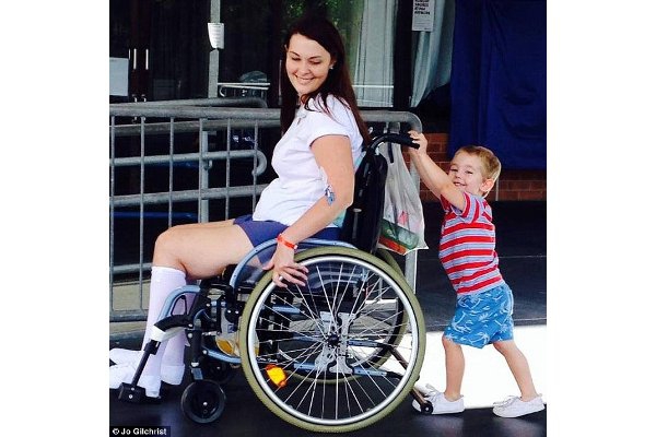 Terkena Infeksi Serius Akibat Kuas Make Up