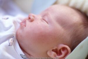 Air Kelapa Sembuhkan Cacar Air?