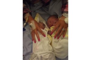 Bayi Pendonor Organ Termuda di Inggris