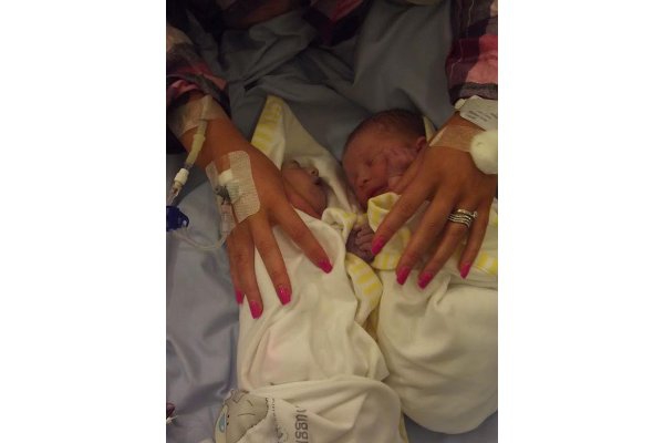 Bayi Pendonor Organ Termuda di Inggris