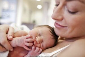 Mengenal Cacat ‘Anencephaly’ pada Bayi